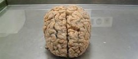 Epilepsy medication facts