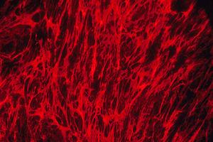 Erectile dysfunction and fibromyalgia
