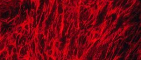 Erectile dysfunction and fibromyalgia