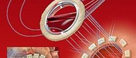 Erectile dysfunction and heart disease