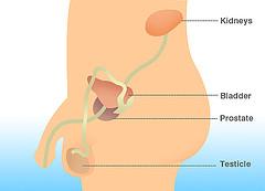 Erectile dysfunction due to prostate surgery