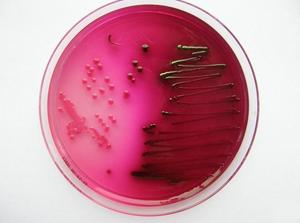 Escherichia coli 0157 H7
