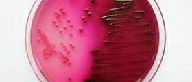 Escherichia coli 0157 H7