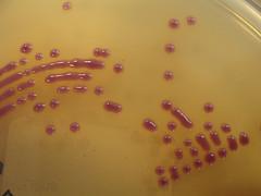 Escherichia coli bacteria