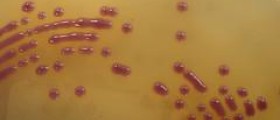 Escherichia coli bacteria