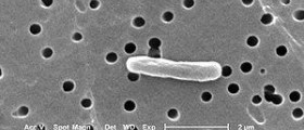 Escherichia coli in urine treatment