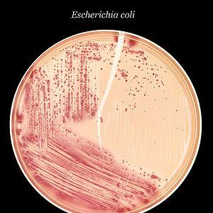 Escherichia coli symptoms in urine