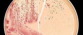Escherichia coli symptoms in urine