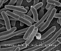 Escherichia coli - UTI in children
