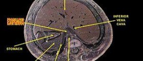 Esophageal cancer later stages