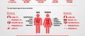 Esophageal cancer overview