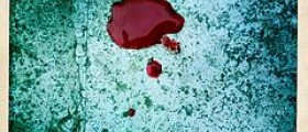 Esophageal cancer vomiting blood