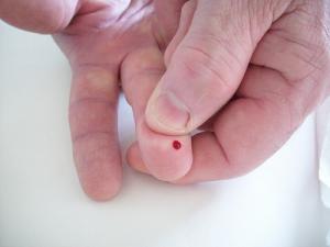 ESR blood test