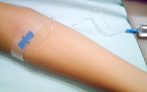 Estrogen by injection