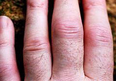 Exercise for people with rheumatoid arthritis