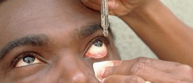 Eye Drops That Lower Cholesterol, Fight Age-Related Blindness