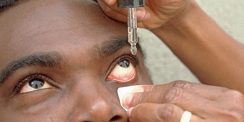 Eye Drops That Lower Cholesterol, Fight Age-Related Blindness
