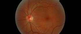 Eye disease and herpes