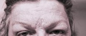 Eye disease headaches
