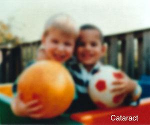 Eye disease in human body: Eye lenses
