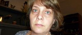 Eye health and dark circles
