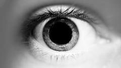 Eye health - Retinal detachment