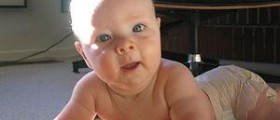 Eye infection - Neonatal conjunctivitis
