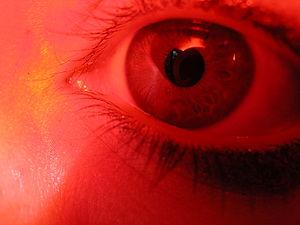 Eye infections