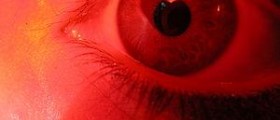 Eye infections
