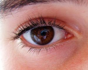 Eye puffiness: natural remedies that work