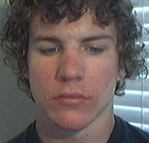 Facial skin conditions