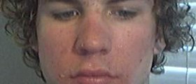 Facial skin conditions