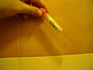 Facts about blood in urine - hematuria