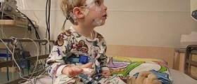 Facts about pediatric falls in hospitals