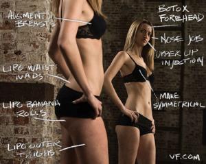 Facts about plastic surgery