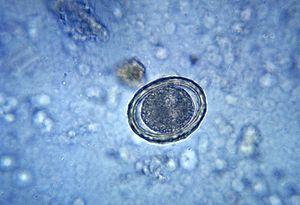 Fertility after 35