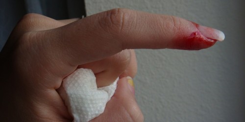 The Coagulation Cascade: A Survival Mechanism