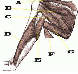 Focal dystonia causes