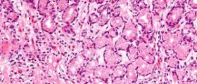 Focusing on lungs health in children