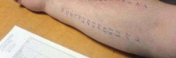 Formaldehyde allergy symptoms