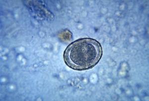 FSH level and fertility