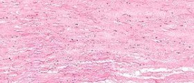 Goals of Shwachman-Diamond syndrome (SDS) treatment