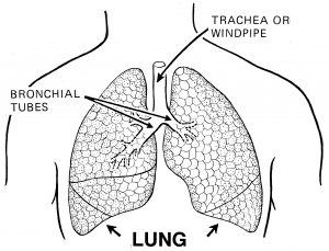 Granulomatous lung disease | General center | SteadyHealth.com