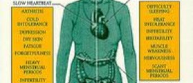 Graves' disease - Overactivity of thyroid hormone production