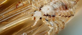 Head Lice: The Truth And The Myths
