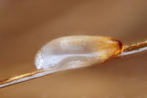 Head lice eggs