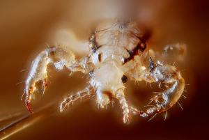 Head lice symptoms