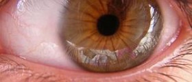 Health and safety eye tests