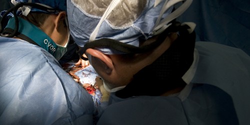 Stent Or Bypass: Which Is Better For Treating Heart Disease In Diabetics?