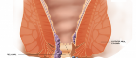 Hemorrhoids remedies which work